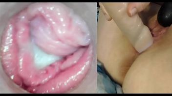 Bolitas blancas en la lengua